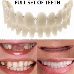 Smile Snap On Falske Tænder Øvre Nedre Dentalfiner Proteser Tanddækselsæt-m.1823 Tw